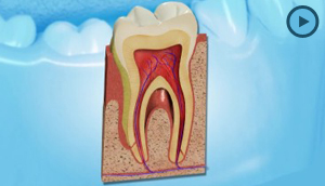 Healthy Gums